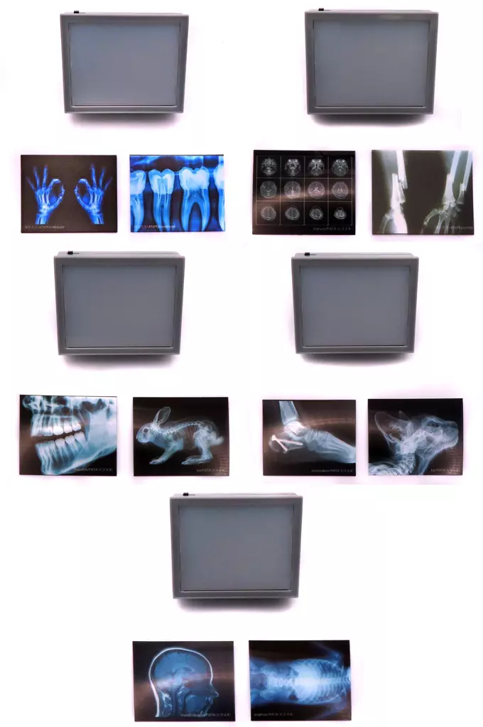 Trading Figure - X-ray light