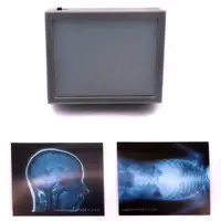 Trading Figure - X-ray light
